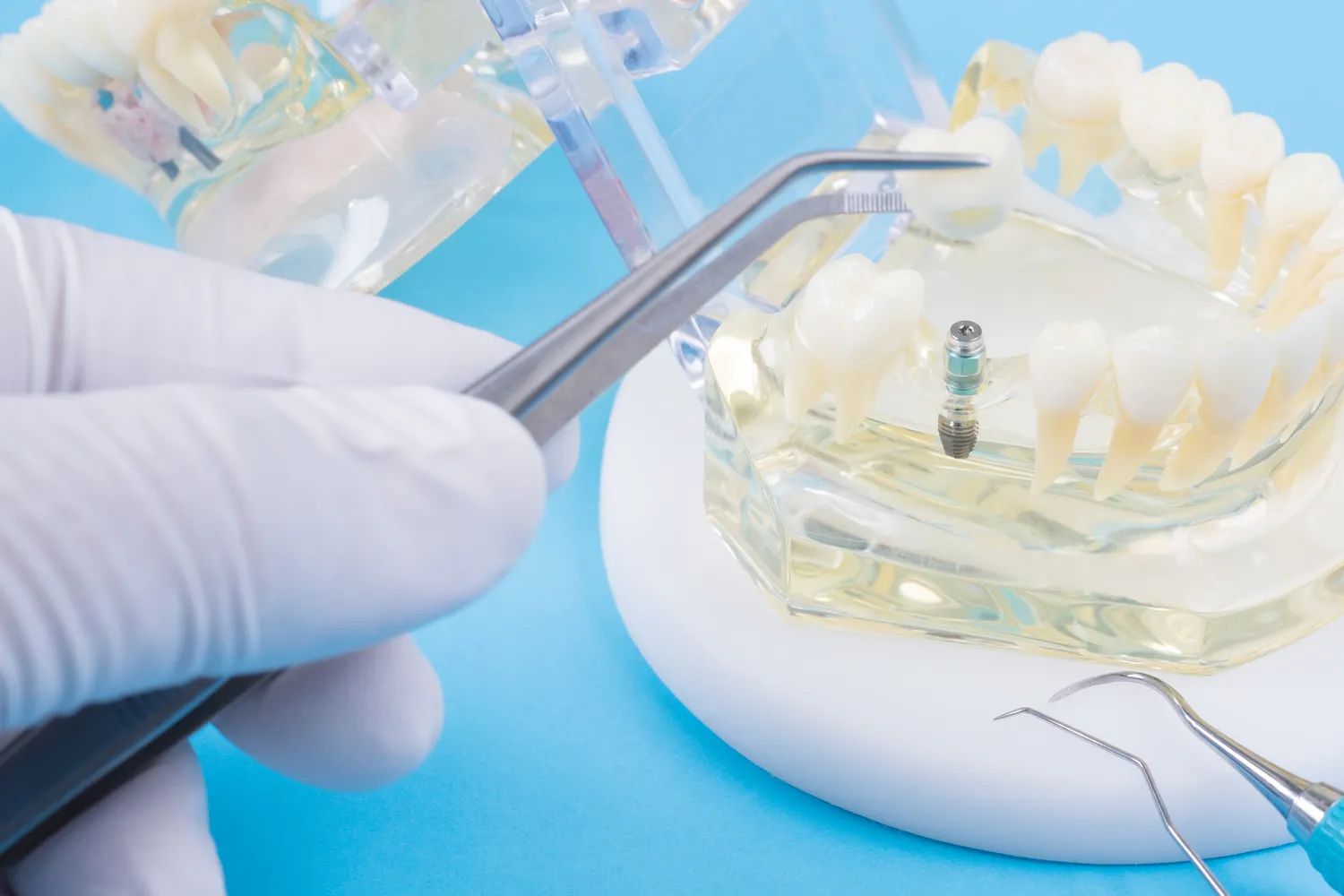 Jak pokonać lęk przed dentystą?