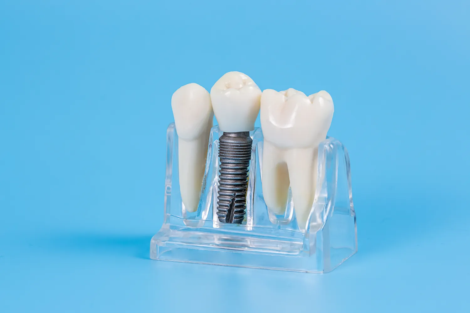 Endodoncja Szczecin